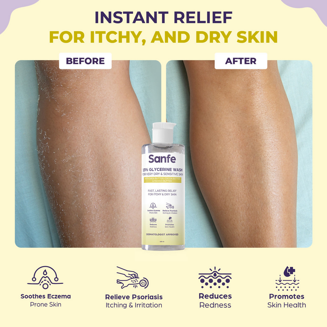 Sanfe Eczema Relief Wash For Very Very Dry Skin