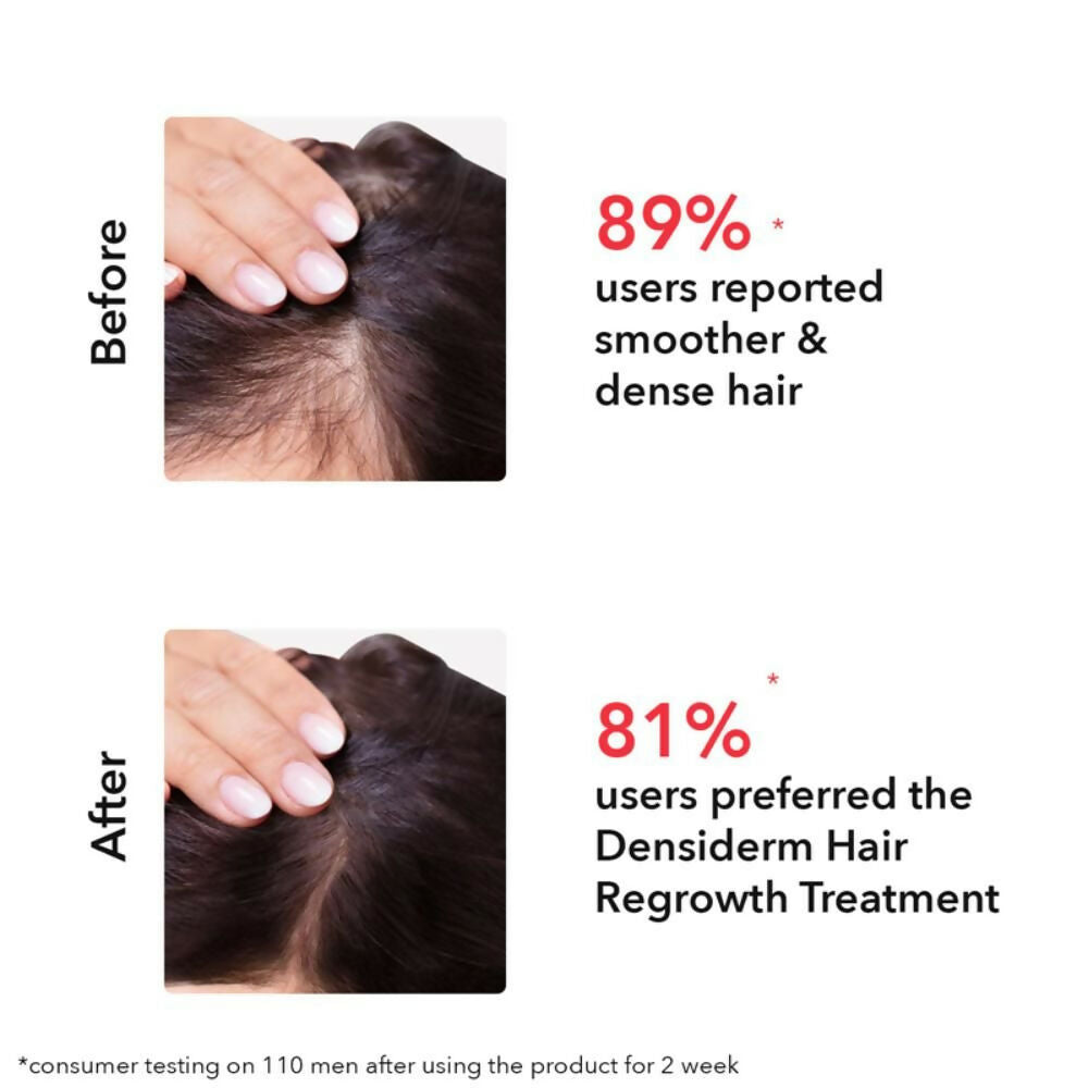 Professional O3+ Women Densiderm Hair Growth Scalp Serum Spray For Anti Hair Loss With Ginseng